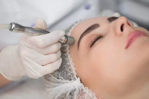 Microdermaobrasion